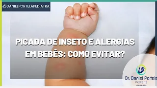 Picada de inseto e alergias em bebês: como evitar?