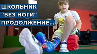 Школьник "Без ноги", что с ним стало? / СБОР на операцию ЗАКРЫТ!