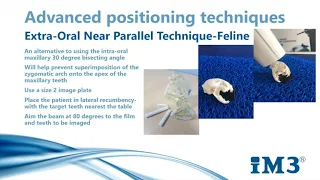 Advanced Dental X Ray Techniques | Im3