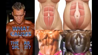 Bodybuilders showing same symptoms as pregnant women?!?