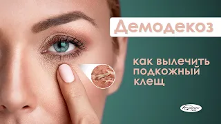 ДЕМОДЕКОЗ: как распознать и избавиться от клеща