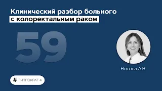 Клинический разбор больного с колоректальным раком. 18.07.22