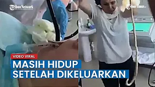 Viral Video Wanita ini Tunjukkan Benda Diduga Ular Keluar dari Mulut Pasien