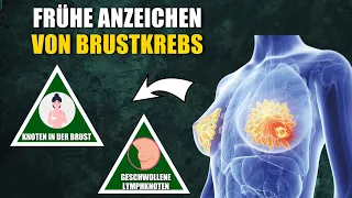 6 Frühe Anzeichen von Brustkrebs, die du nicht ignorieren solltest