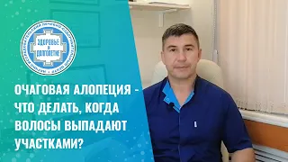 😲 Очаговая алопеция   что делать, когда волосы выпадают участками?