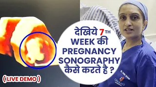 देखिये 7th Weeks में आपका Baby कैसे दिखता है ? | Sonography Week By Week Pregnancy | Dr Asha Gavade
