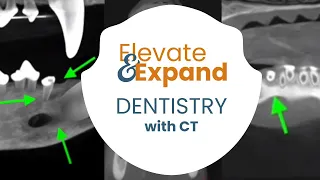 Elevate and Expand your DENTISTRY practice with CT