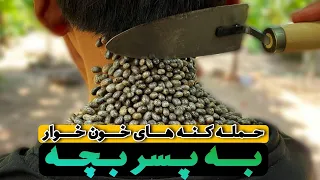 حمله کنه های خون خوار به پسر بچه - ticks on human