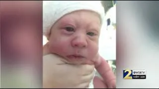 Baby born missing part of skull thriving against all odds