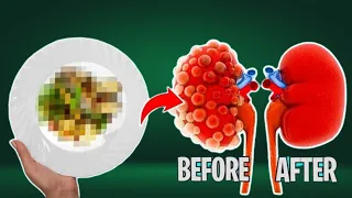 The #1 Food for Toxic Kidneys with the Ultimate Superfood