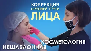 Коррекция средней трети лица или как НЕ стать «жертвой» навязанных стереотипов красоты?