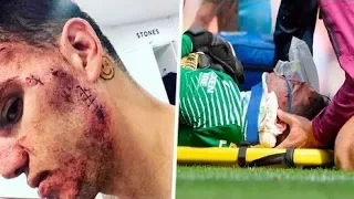 ►Top 10 Most Scary Injuries Goalkeepers