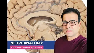 NEUROANATOMY CADAVERIC IMAGES DISCUSSION