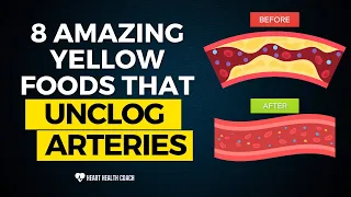 8 Amazing Yellow Foods That Unclog Arteries