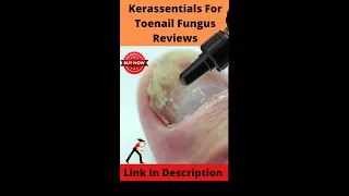 Kerassentials For Toenail Fungus Reviews #shorts #youtube shorts
