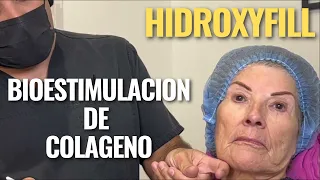 BIOESTIMULACIÓN DE COLÁGENO - HYDROXYFILL TRATAMIENTO