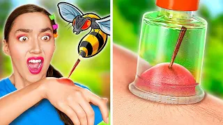 30+ BEACH HACKS & CAMPING HACKS FOR SUMMER || I Got Stung by A Bee by BadaBOOM!