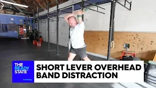 Short Lever Overhead Band Distraction