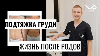 История нашей пациентки. Мастопексия - операция по уменьшению груди.