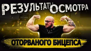 Результаты осмотра оторваного бицепса