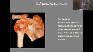 Лучевая диагностика заболеваний опорно двигательной системы