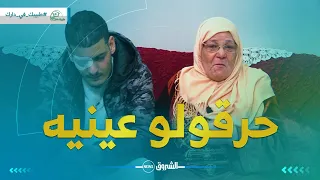 طبيبك في دارك  🩺 | حكـــاية نسيم مؤلمة جدا .. في حلقة أخرى من الاعتداءات باستعمال روح الملح 😭😭