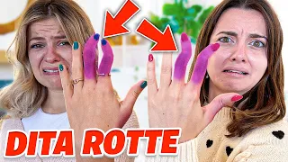 DANI e NINNA si SONO ROTTE le DITA..! 💥