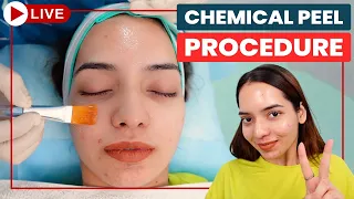 CHEMICAL PEELS -Step by Step | Acne Scar Treatment in Delhi | Chemical Peeling Treatment| Dr Jangid
