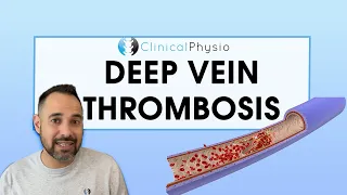 What is a DVT? How do you Diagnose and Treat it? | Expert Explains Everything You Need To Know!