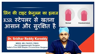 टाइट फ्रेनुलम का इलाज | Treatment for Tight Frenulum | KSR Stapler Circumcision | Circum Cure Clinic