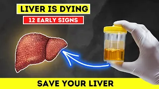 12 Warning Signs Your Liver Needs Help: How to Reverse Fatty Liver Damage Naturally!