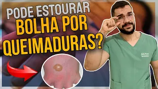 BOLHA DA QUEIMADURA: ESTOURA OU NÃO? | ENTENDA O CASO