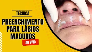 Preenchimento labial revelado: Técnica ao vivo para lábios maduros!