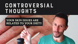 Controversial Thoughts: Your skin issues are related to your diet!!