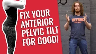 How to Fix an Anterior Pelvic Tilt in 5 Minutes