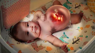 Los Médicos Descubren Que Una Niña Nació Embarazada De Dos Bebés. La Razón Es Impactante