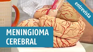 MENINGIOMA CEREBRAL: um dos tumores cerebrais mais comuns.
