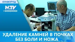 УДАЛЕНИЕ КАМНЕЙ В ПОЧКАХ БЕЗ БОЛИ И НОЖА