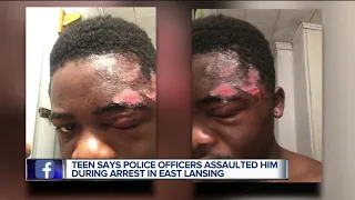 Teen says police officers assaulted him during arrest in East Lansing