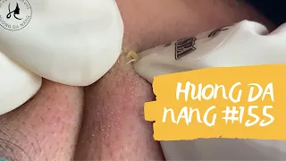 #155 | Huong Da Nang