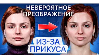 Как прикус влияет на асимметрию лица? Исправление прикуса ДО и ПОСЛЕ