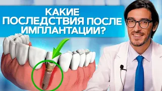 Какие последствия после имплантации? Какие ждать последствия после имплантации и синус лифтинга?