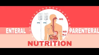 NUTRITIONAL SUPPORT | ENTERAL & PARENTERAL NUTRITION (2/2)