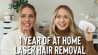 1 Year of Laser Hair Removal At home RESULTS! - KayleyMelissa