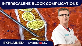 The Role of Fascia in Interscalene Plexus & other NB Complications - Crash course with Dr. Hadzic