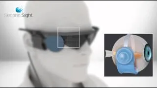 Bionic Eye Implant Allow Blind And Vision Impaired To See