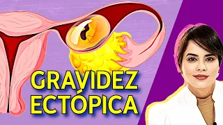 Alerta na Gravidez: Entenda o Perigo Silencioso da Gravidez Ectópica!