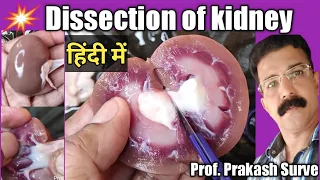 Dissection of Kidney complete Explanation ( हिंदी में अनुवाद ) By Prof. Prakash Surve ( Moderator )