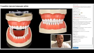 Вебинар 5 ошибок при реставрации зубов. Сошников