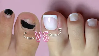 FRENCH PEDICURE - comment réparer 𝟙 ongle cassé ou fissuré  🤓